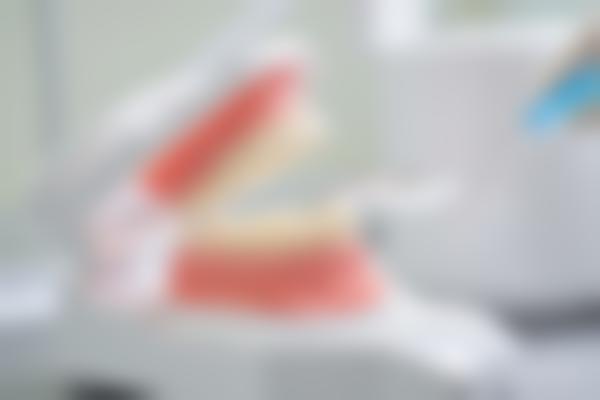 微创拔牙怎么选？这份南京江宁拔牙指南请收好