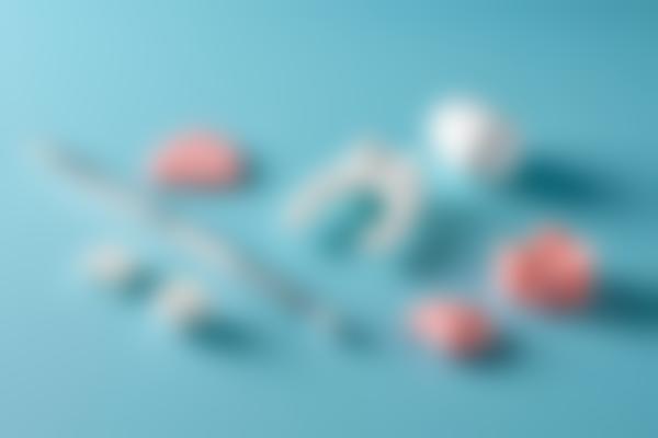 牙套一般需要多少钱？新牙套价格表在这里