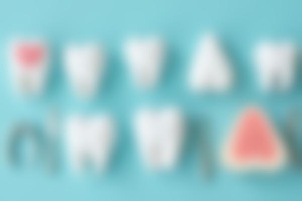 烤瓷牙是什么？做一颗烤瓷牙要多少钱？