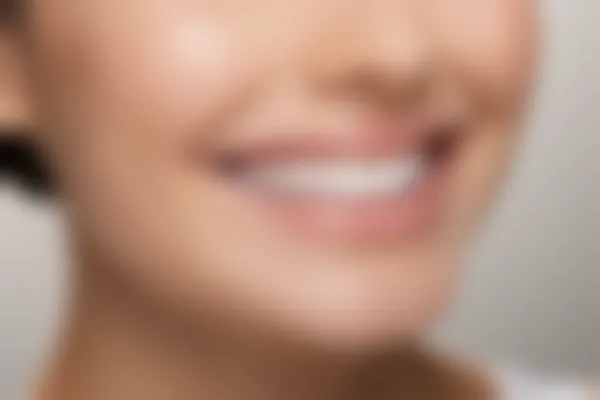 正畸治疗过程中是否必须拔牙？了解正畸拔牙的必要性与影响。