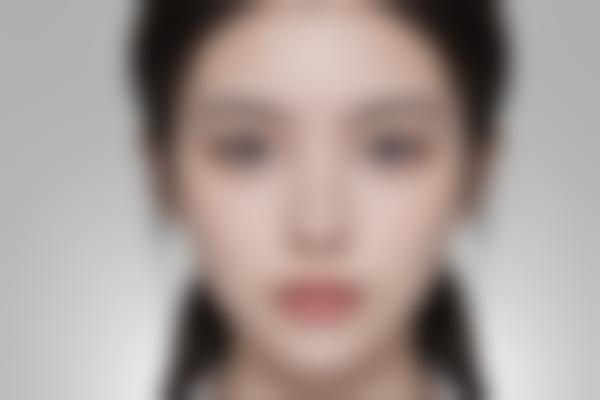 2、马建生诊疗手法