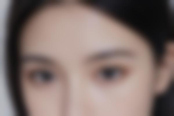 长沙向艺鼻整形技术好，向艺医生做鼻子自然又精致，价格2万元起！