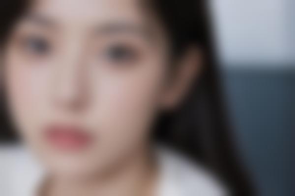 恩施张勇医生整形修复技术强,修复和鼻修复价格合理自然!