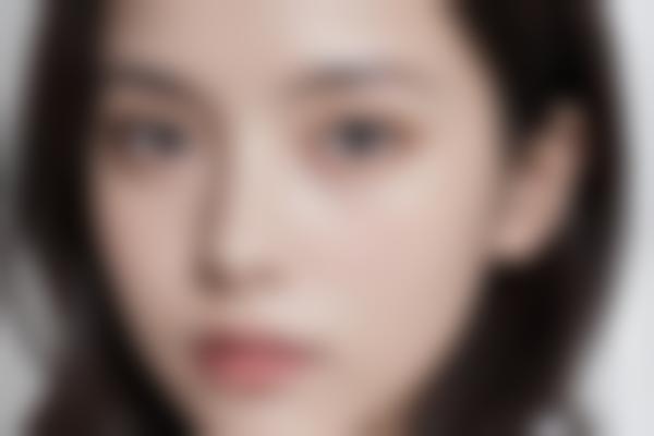 广州蒋思生整形技术超绝!20年经验打造自然鼻综合、精致轮廓