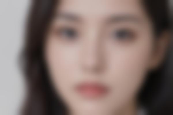 北京冯斌医生脂肪好，冯斌脂肪价格合理打造自然精致轮廓！