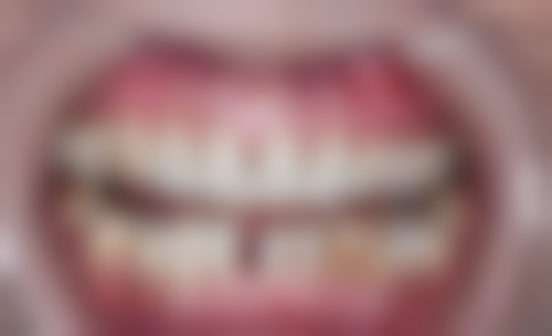 友恩口腔连锁（大浪旗舰店）怎么样？该门诊诊疗项目丰富，涵盖牙齿矫正、美白、补牙、儿童牙科等多个领域