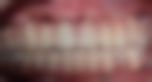 深圳友恩口腔门诊部乘车路线：