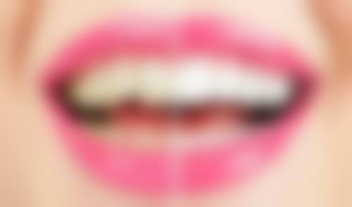 江苏泰州靖江刘超口腔核心项目