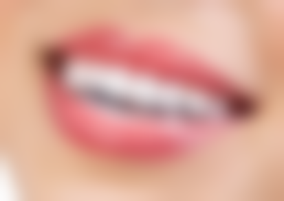 广东惠州丽齿口腔门诊实例参考