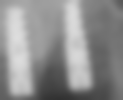 湖北襄阳王玲口腔怎么预约?