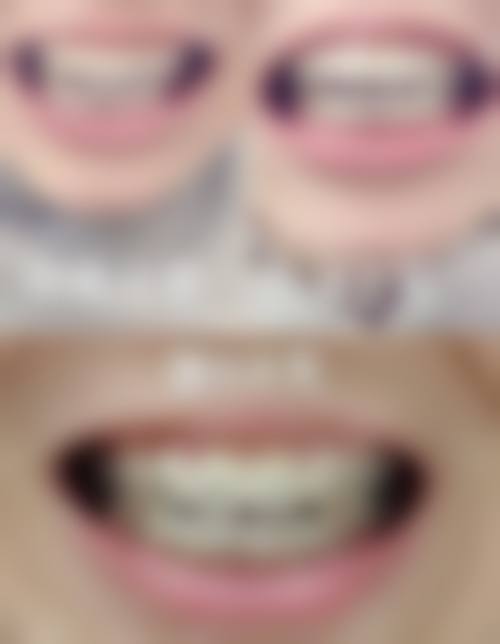 杭州雅正口腔正规吗？看资质