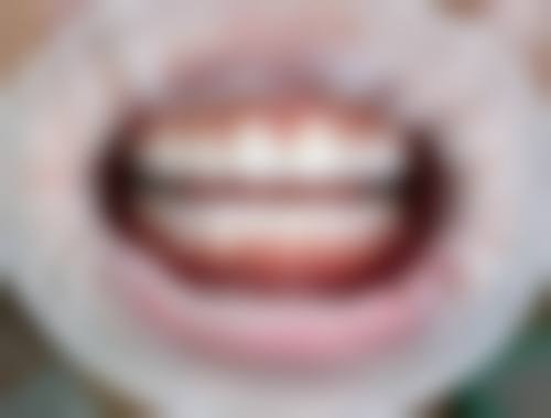 芗城佳聚美口腔诊所价格表(仅供参考)