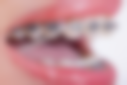 蒋涛擅长项目列表