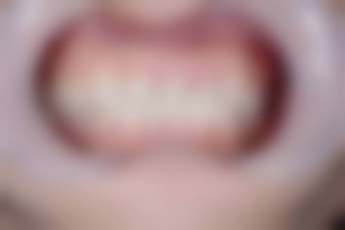 邯郸正植口腔门诊部核心项目