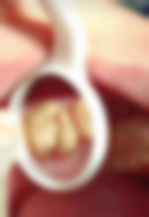 泉州安格尔口腔门诊部核心项目