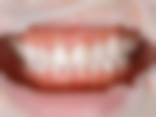 荆州市第一人民医院口腔科实例参考