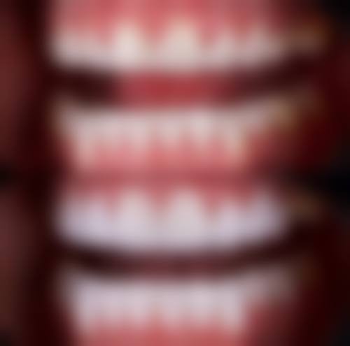 荆州市第一人民医院口腔科价格表（仅供参考）