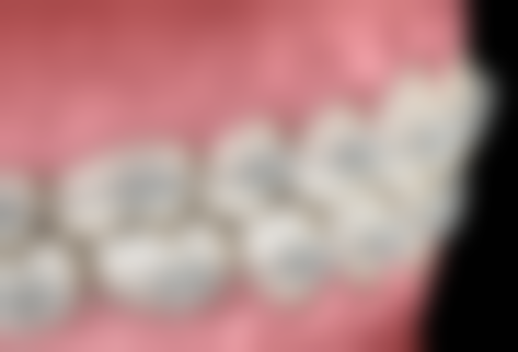 广州普宁乐可口腔价格表(仅供参考)