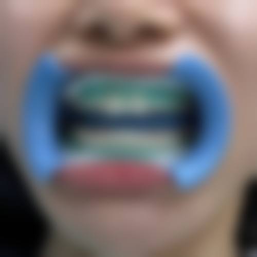 山东潍坊三贤佳医口腔连锁价格表(仅供参考)