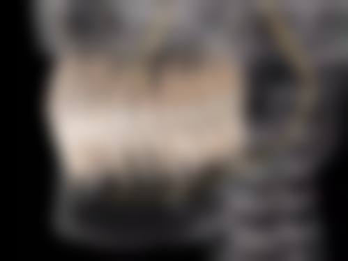 东莞中齿口腔诊所正规吗？看资质