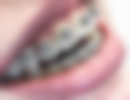 陕西商洛山阳县桂氏口腔医生团队