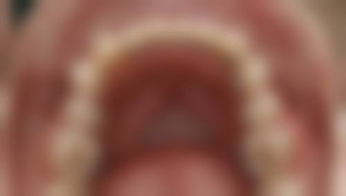 韩国人爱首尔牙科医院正规吗？看资质