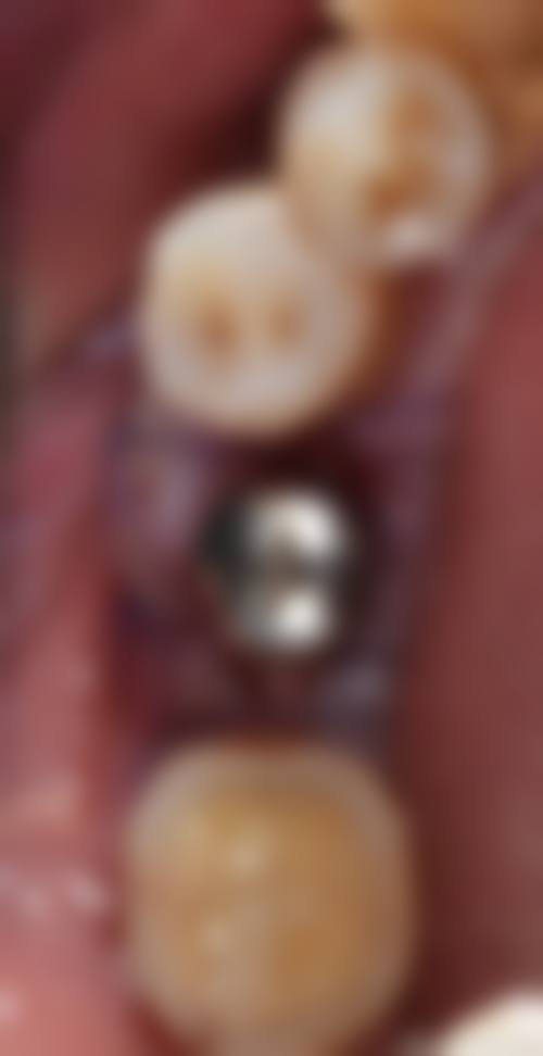 山东临沂兰山华东口腔怎么预约？