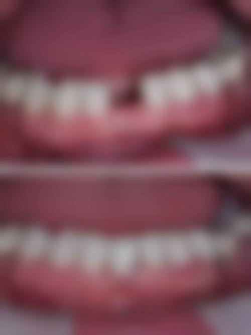 南涧叶子口腔医疗门诊部核心项目