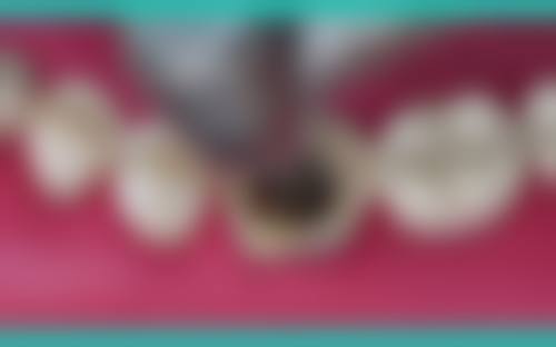 成都龙泉驿华诺口腔诊所怎么预约？