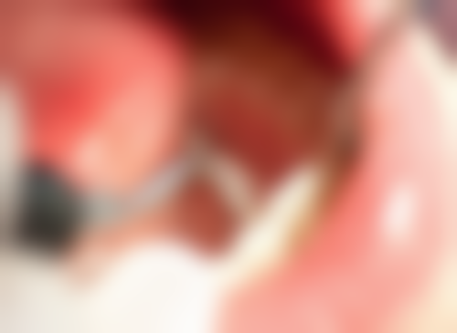 宜昌中汉口腔（伍家岗门诊）实例参考