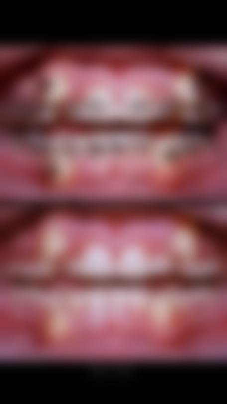 肥城牙牙乐口腔怎么预约？