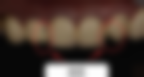 苏州苏适美口腔怎么预约？