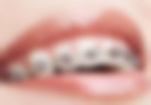 重庆康悦美鸿雲口腔(锦虹店)价格表(仅供参考)