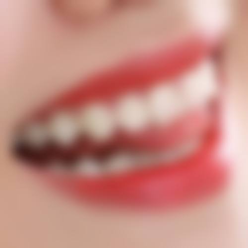 湖南中惠时代口腔北辰门诊部怎么预约?