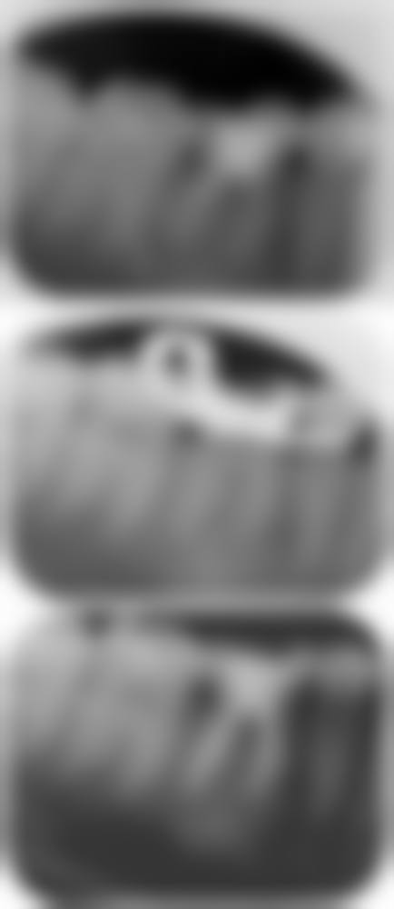 溪美康口腔门诊部实例参考