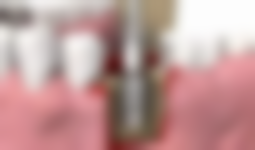 福州舒华口腔门诊部价格表（仅供参考）