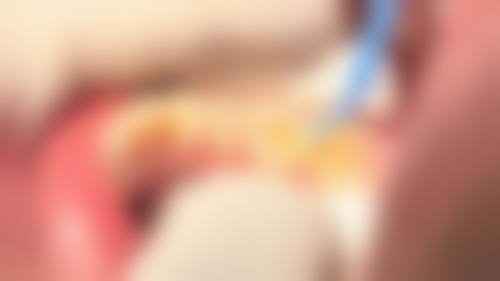 佛山顺德龙江康博口腔门诊部价格表（仅供参考）