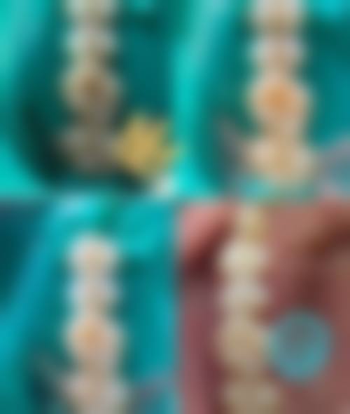 福州舒华口腔门诊部核心项目