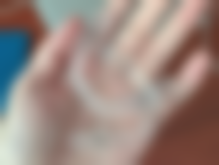 温州瓯雅口腔实例参考