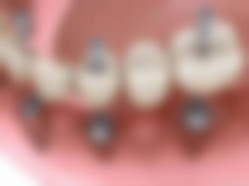 南京冯学富口腔诊所怎么预约？