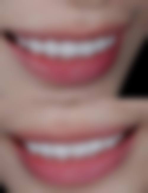 韩秋凤预约方式