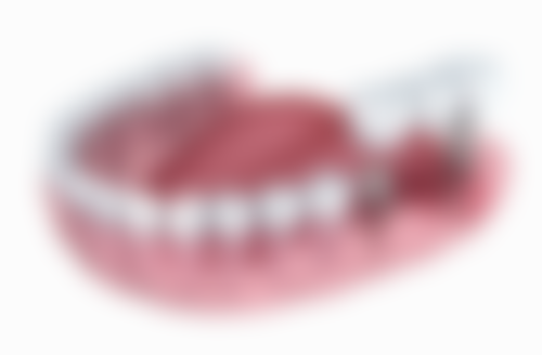 杭州品凯口腔（盈佳诊所）价格表（仅供参考）