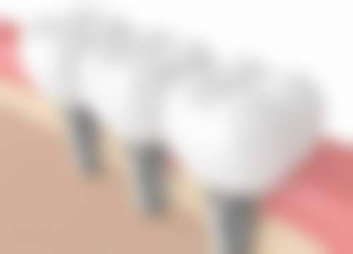 江苏徐州睢宁惠康口腔实例参考