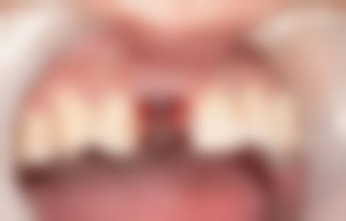 山东济南天桥天成口腔诊所价格表（仅供参考）