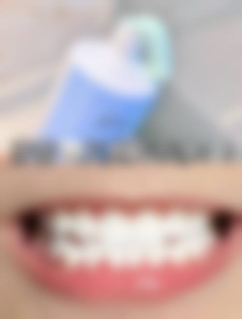 江苏徐州睢宁惠康口腔怎么预约?