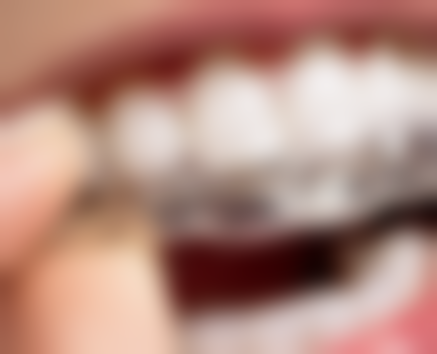 湖南娄底康健口腔怎么预约？