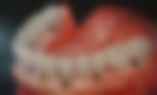 辽阳市灯塔市应宇东口腔价格表（仅供参考）