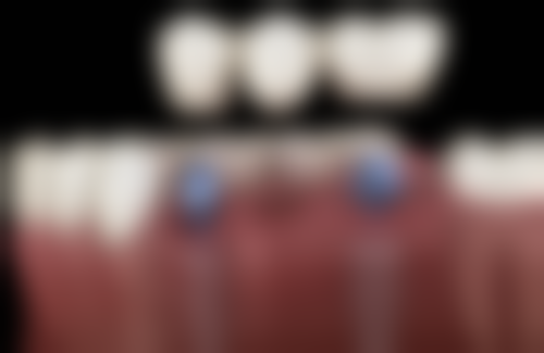 日照瑞美口腔门诊部（锦绣花园院区）价格表（仅供参考）