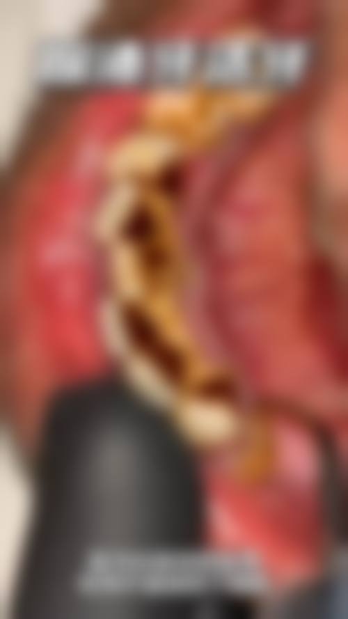 宁波恒祥口腔门诊部怎么预约？