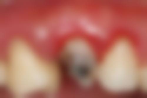 雷思锋预约方式